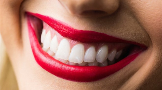 Žuti zubi su snažniji od bijelih zato ne forsirajte izbjeljivanje 