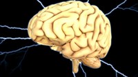 Možemo li spriječiti moždani udar?