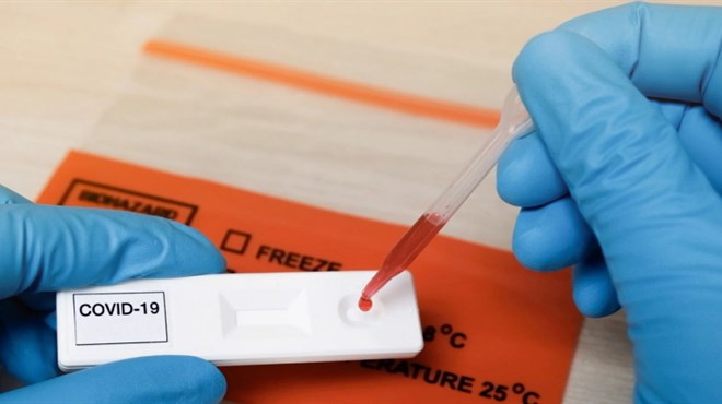 U Grude stigli i testovi koji mogu utvrditi jeste li preboljeli koronavirus